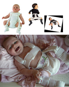 Infant in a therapeutic hip brace