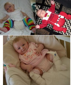 Double diaper or brace keeping the legs open